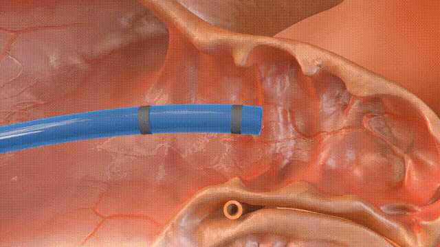 3月21日.gif 3月21日.gif