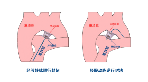 示意图1(1).png 示意图1(1).png