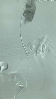 compressed_1770972515230.gif compressed_1770972515230.gif